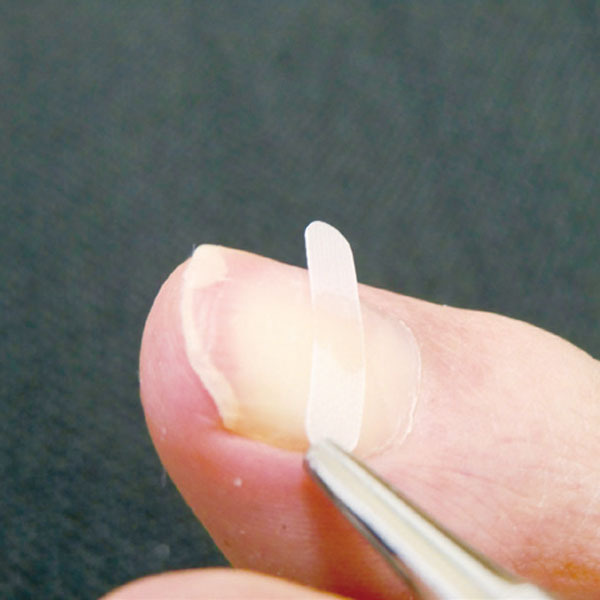 城南巻き爪矯正センター（こやま整骨院併設）