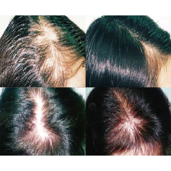 アクティ ヘアクリニック ～茨城石岡O.C.～