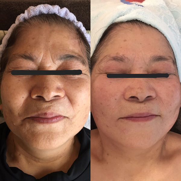 高萩市にあるシワたるみ専門温活サロン　Uny～ウーニー～