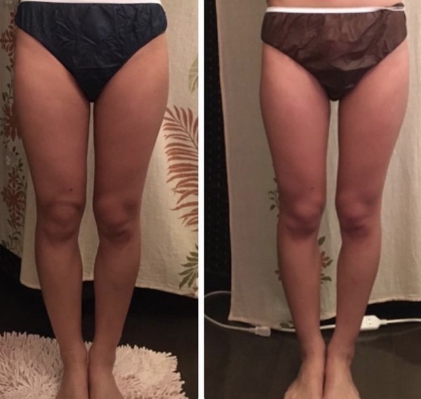 ダイエット＆たるみ改善専門店
miracleつくばみどりの店