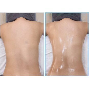 最新マイクロ波痩身「サーマウェーブ」